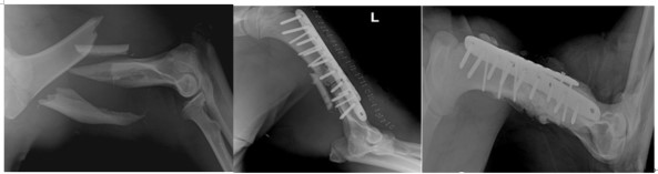  수술 전,  수술 직후,  수술 62일 후 방사선 사진